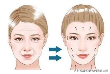 热玛吉操作时正确的手法,热玛吉医生操作时有技巧吗