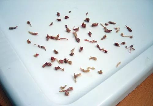 人为啥喜欢挖鼻屎,为什么我们爱抠鼻屎