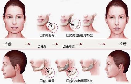 国字脸改变脸型方法,国字脸男怎么能使脸变尖