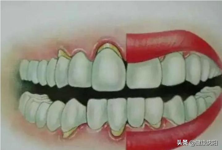 健康科普堂提示,健康科普堂的缺点