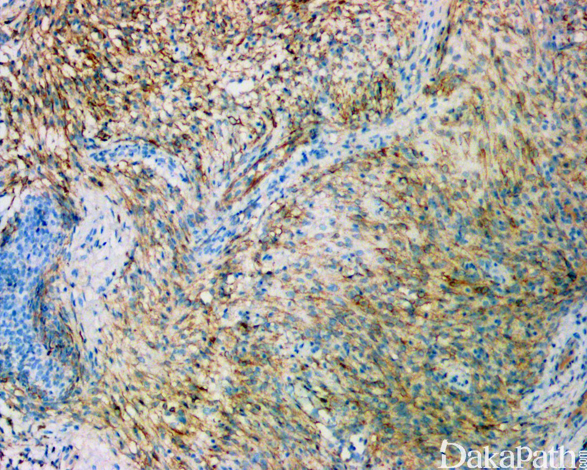 魏则西生前求救视频,魏则西家人有得到赔偿吗