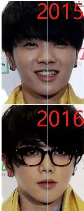 华晨宇植发的医院是哪里,华晨宇植发图片是真的吗