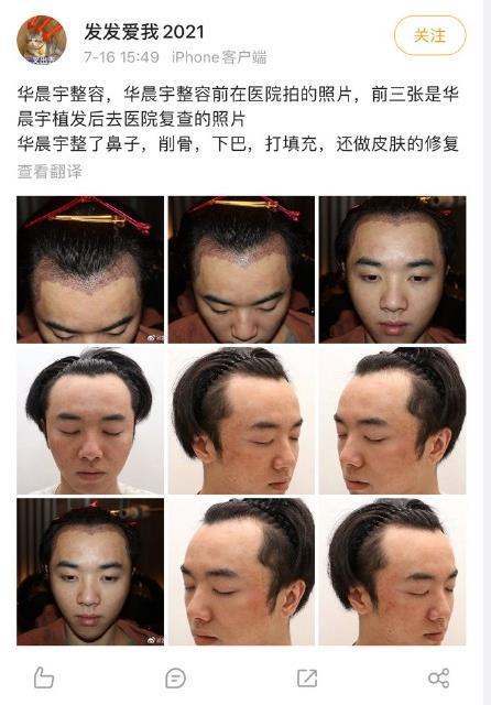 华晨宇被曝整容植发后首度现身打扮低调行色匆匆