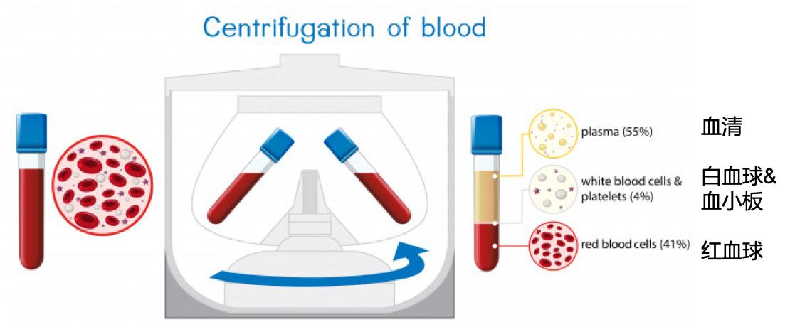 输血为什么要血型一样,为什么输血需要配型
