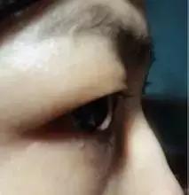 把水光针当饭吃?这位网红简直丧心病狂!整容后年入千万