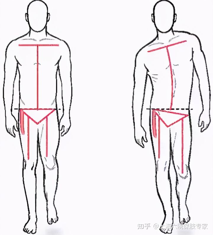 矫形骨科的知识,文根矫形
