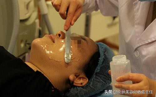 热玛吉操作时正确的手法,热玛吉医生操作时有技巧吗