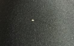 毛囊口还有点发根还能长出来吗,发根从毛囊里掉了还会长出来吗