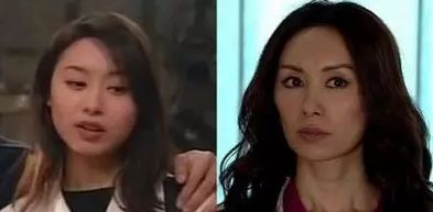 脸颊胶原蛋白补充,脸颊凹陷胶原蛋白流失如何补过来