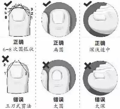 跑步脚上出现黑趾甲该怎么处理,跑步黑脚趾怎么处理