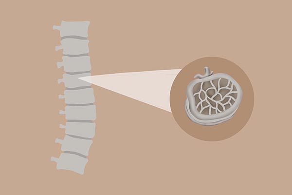 香港特首林郑月娥摔倒骨折，中老年的骨骼健康问题不能小视
