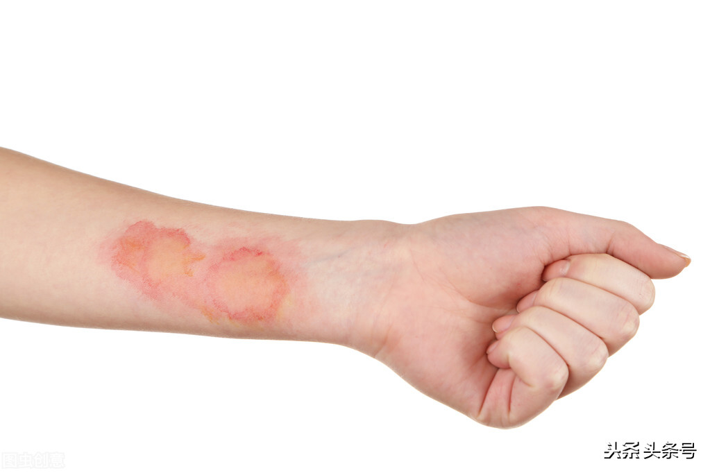 理疗仪产品侵权责任,美容院起诉顾客侵权怎么举证