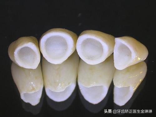 山东烤瓷牙什么牌子好,乌市烤瓷牙全瓷的多少钱一颗
