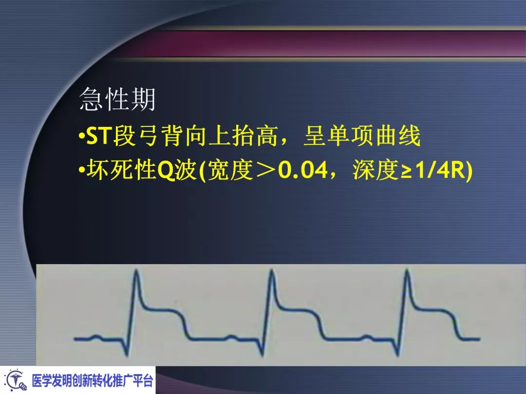 麻醉手术常见心律失常处理,麻醉引起心脏骤停原因