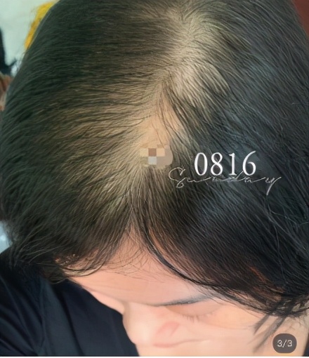 蓖麻油可以用来护发吗,蓖麻油薄荷油治疗脱发