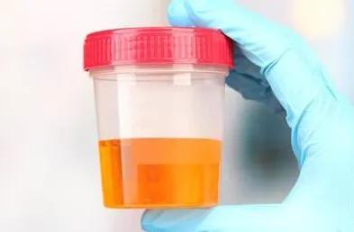 感冒咳嗽会导致血尿吗,感冒了出现血尿怎么回事