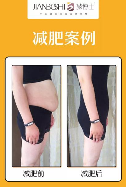 产后肥胖先减肥还是先修复腹直肌,产后减肥胖最快的方法