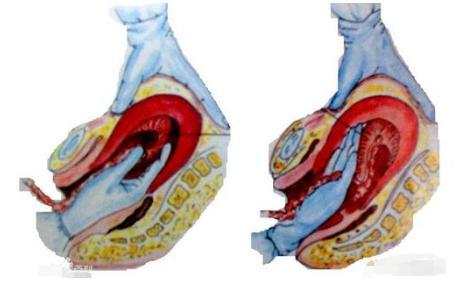 为什么顺产那么疼？哪里疼、有多疼，分娩过程解读，看完心疼产妇
