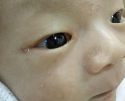 孩子总是发火易怒是什么原因,小孩经常发火对身体的危害