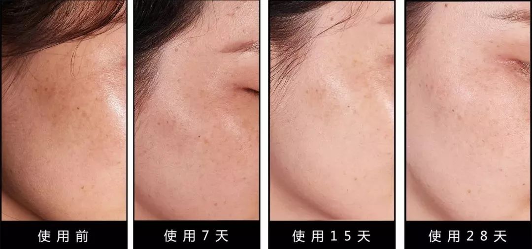 张嘉倪护肤油,张嘉倪分享化妆品