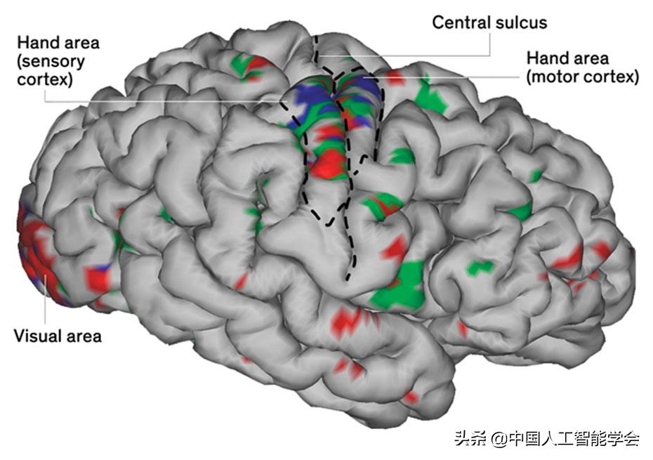 一千个电极植入大脑,大脑植入微电极