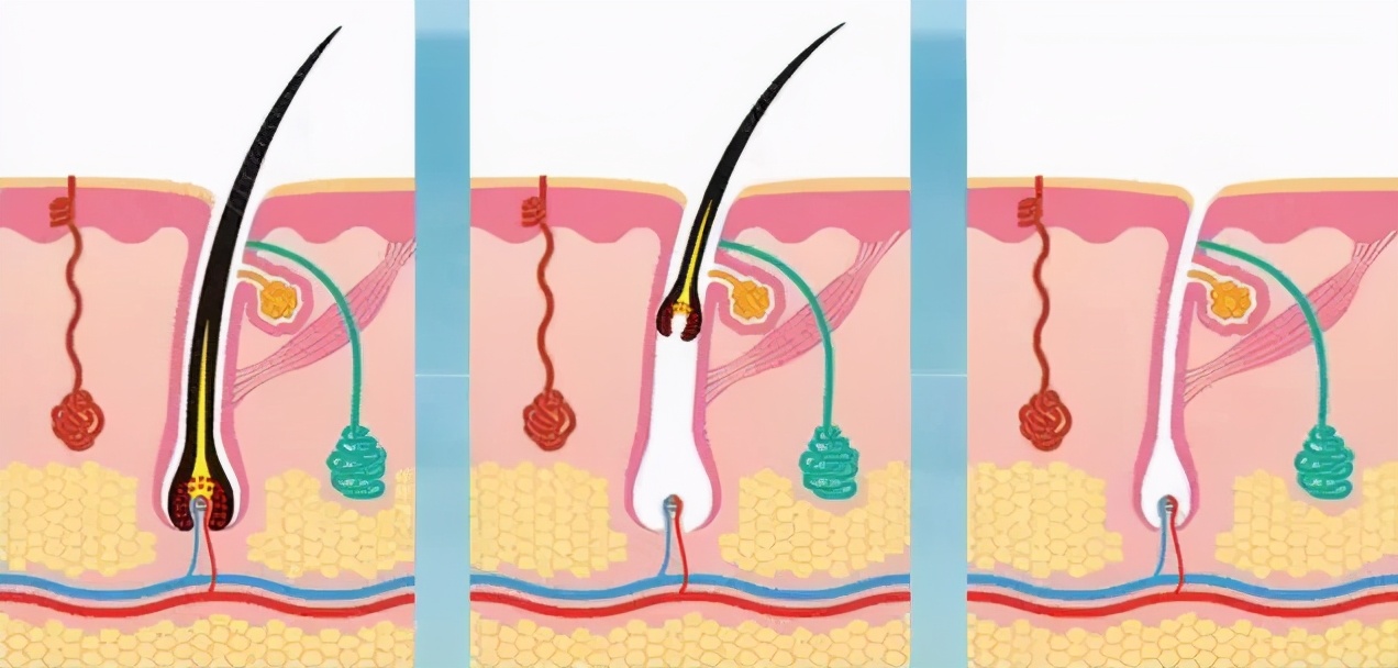 脱毛避免踩坑的事项,女性夏季脱毛7个误区要当心