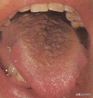 最实用的舌诊图六大舌象,舌诊深入学习书