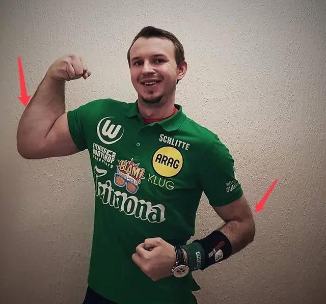 怎么防止肌肉练歪,肌肉歪了怎么矫正图片