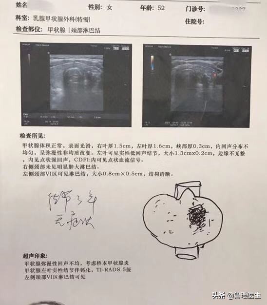 “大夫，我刚做完甲穿提示结节是良性，为什么还要让我做？”