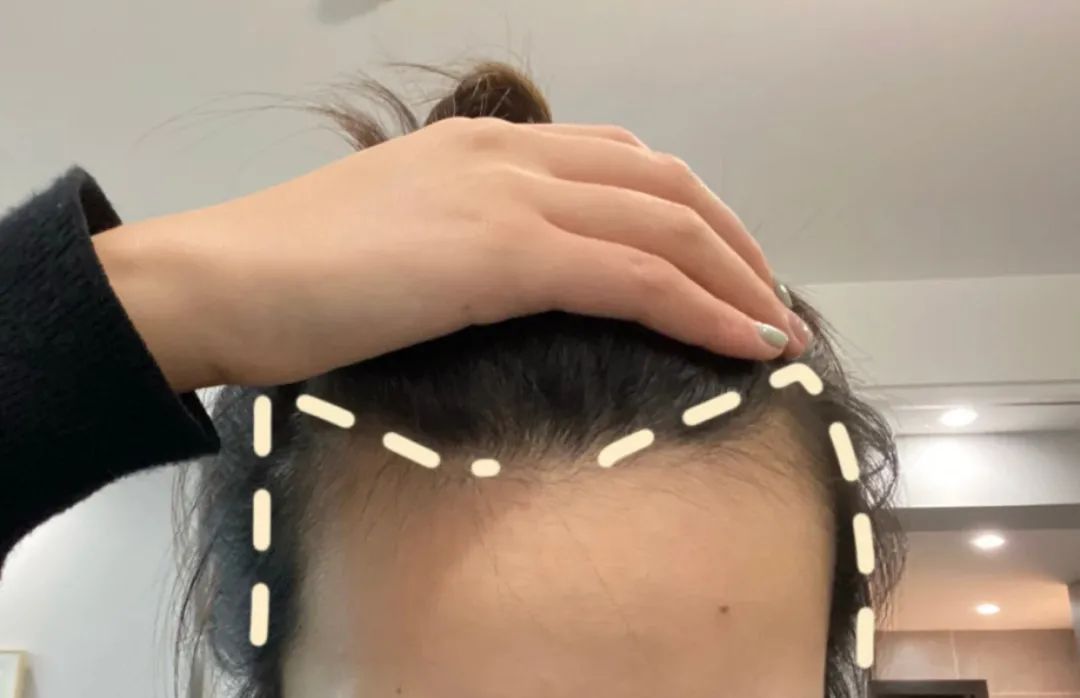 你是什么脸型适合什么发型测试,你是什么脸型就适合什么发型