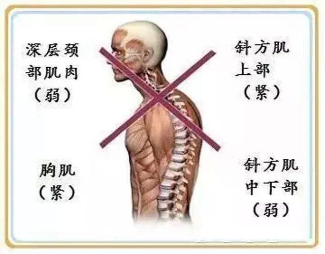 上胸为什么是最难练的原因,上胸怎么都练不大