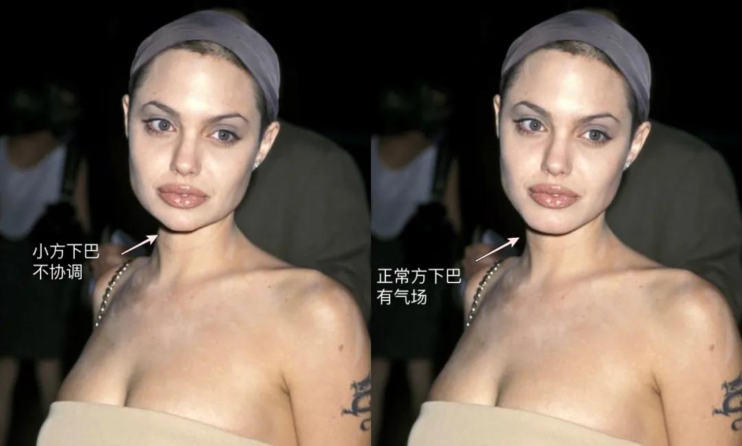 如何垫下巴看起来又翘又尖,怎么垫下巴改善下巴短平