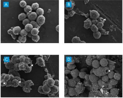 癌症疫苗最新研发消息,癌症疫苗或将问世