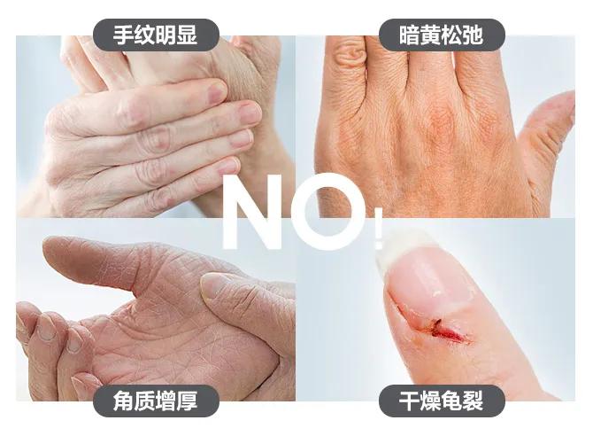天气干燥手指角化皲裂,洗手频繁干裂脱皮用什么药