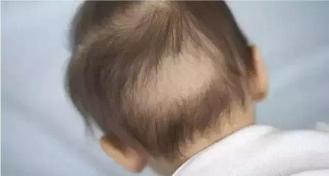 宝宝发烧妈妈要忌嘴吗,发烧超过几度不能给宝宝喂奶