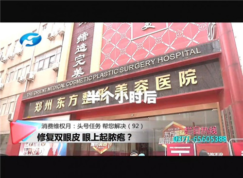 郑州市修复双眼皮,双眼皮缝线处发炎脓包怎么处理