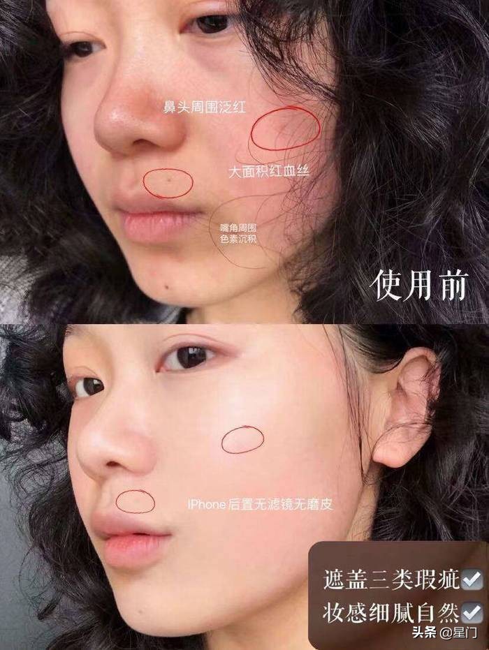 毛孔粗大肤色不均泛红出油,毛孔粗大肌肤暗沉干燥泛红