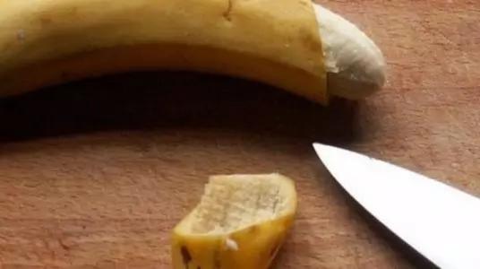 包皮过长除了做手术还有什么办法,包皮手术家长们看吗