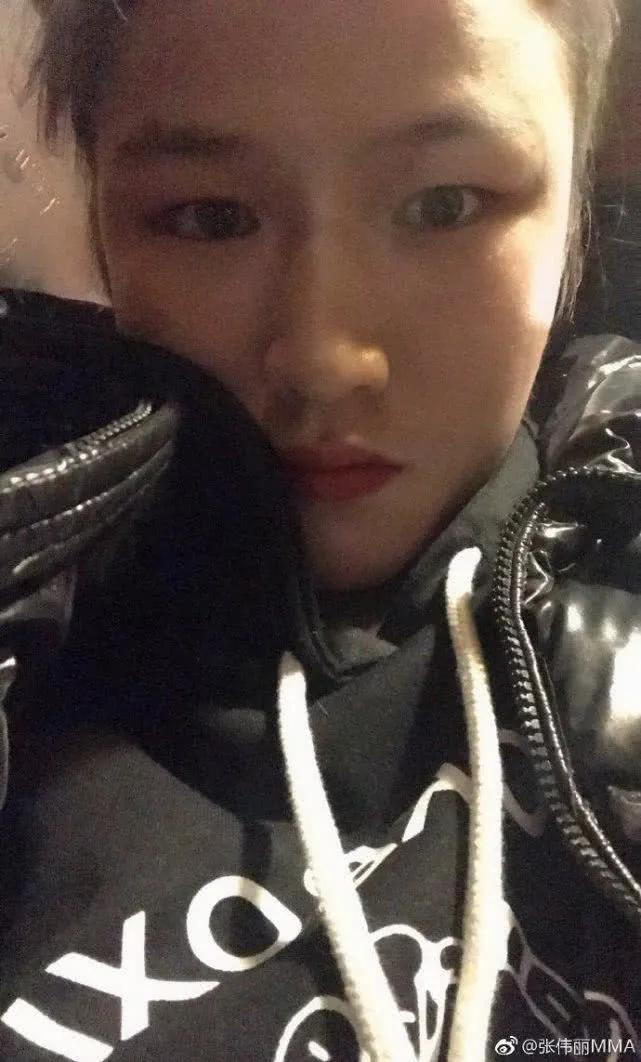 张伟丽为什么赢一次就冠军了,张伟丽为什么这么快能打冠军