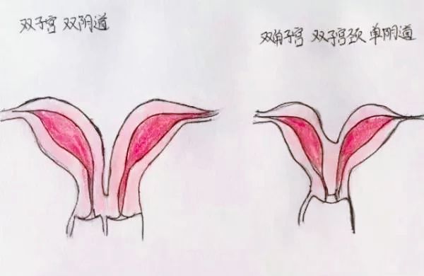 医生精美手绘图片大全,宫颈息肉红蓝铅笔手绘图
