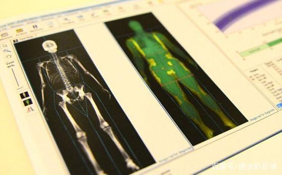 金牌第一！奥运健儿都体检啥？这个冷知识你绝对没想到