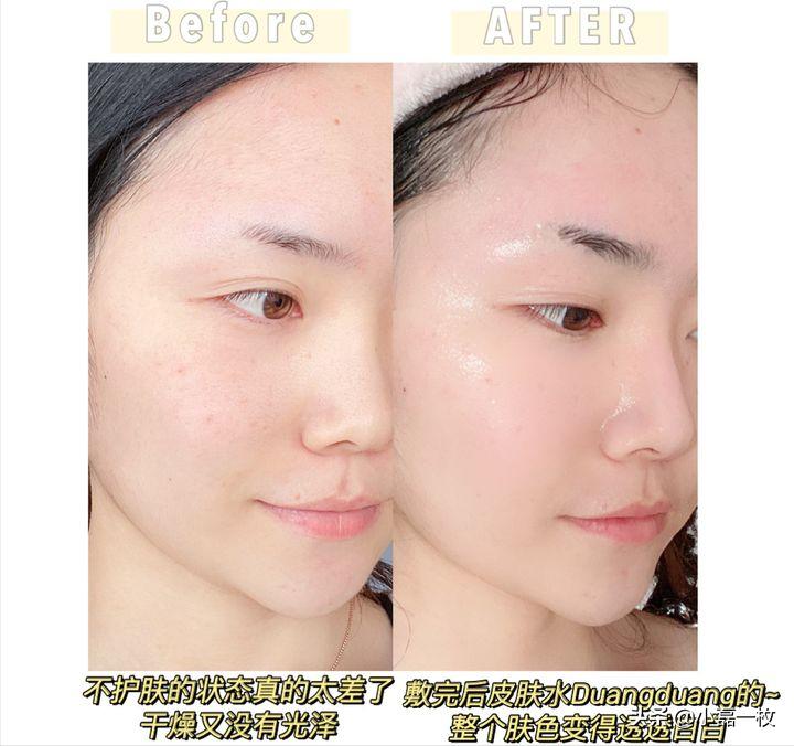 熬夜脸色蜡黄用什么精华,熬夜蜡黄脸怎么改善
