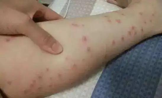 泰国青草止痒膏正品方便携带,夏季必备泰国青草膏