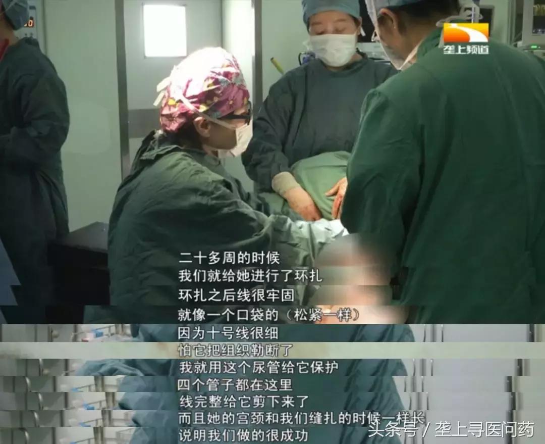 怀孕13周孩子会自然掉出来吗,孕中期觉得孩子要掉出来