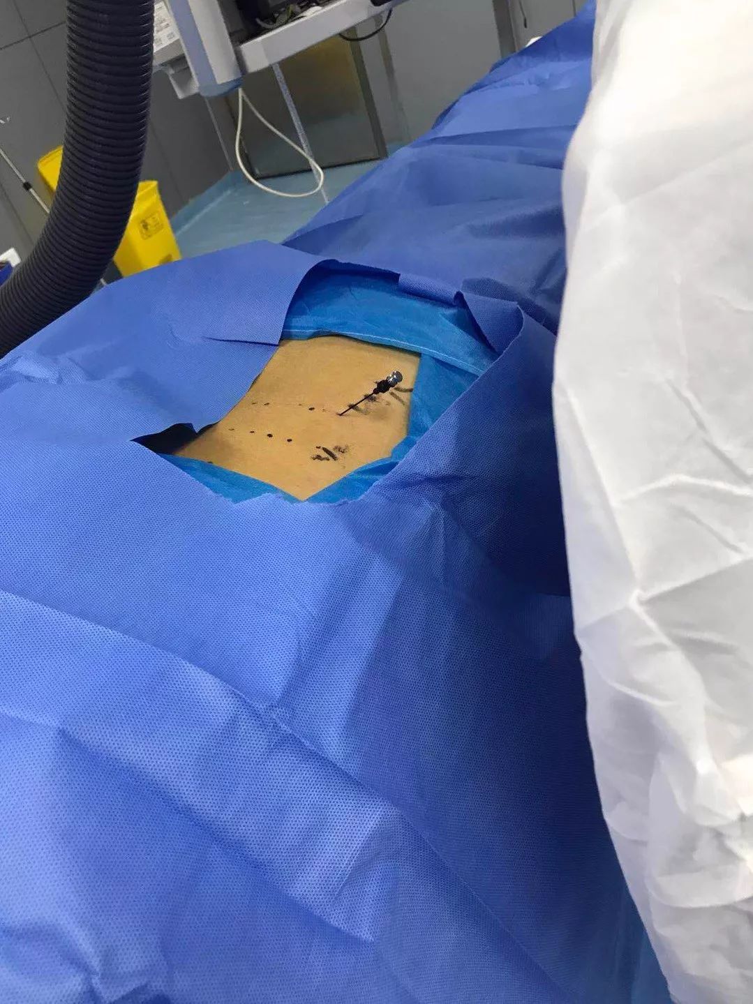 河科大一附院射频消融术,河科大一附院骨科门诊