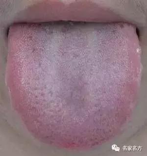 舌头是人体自带的体检表，一旦出现这个信号，马上去医院