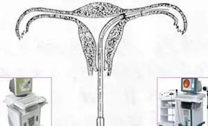 输卵管性不孕的最佳治疗方法,输卵管性不孕的中医治疗要点