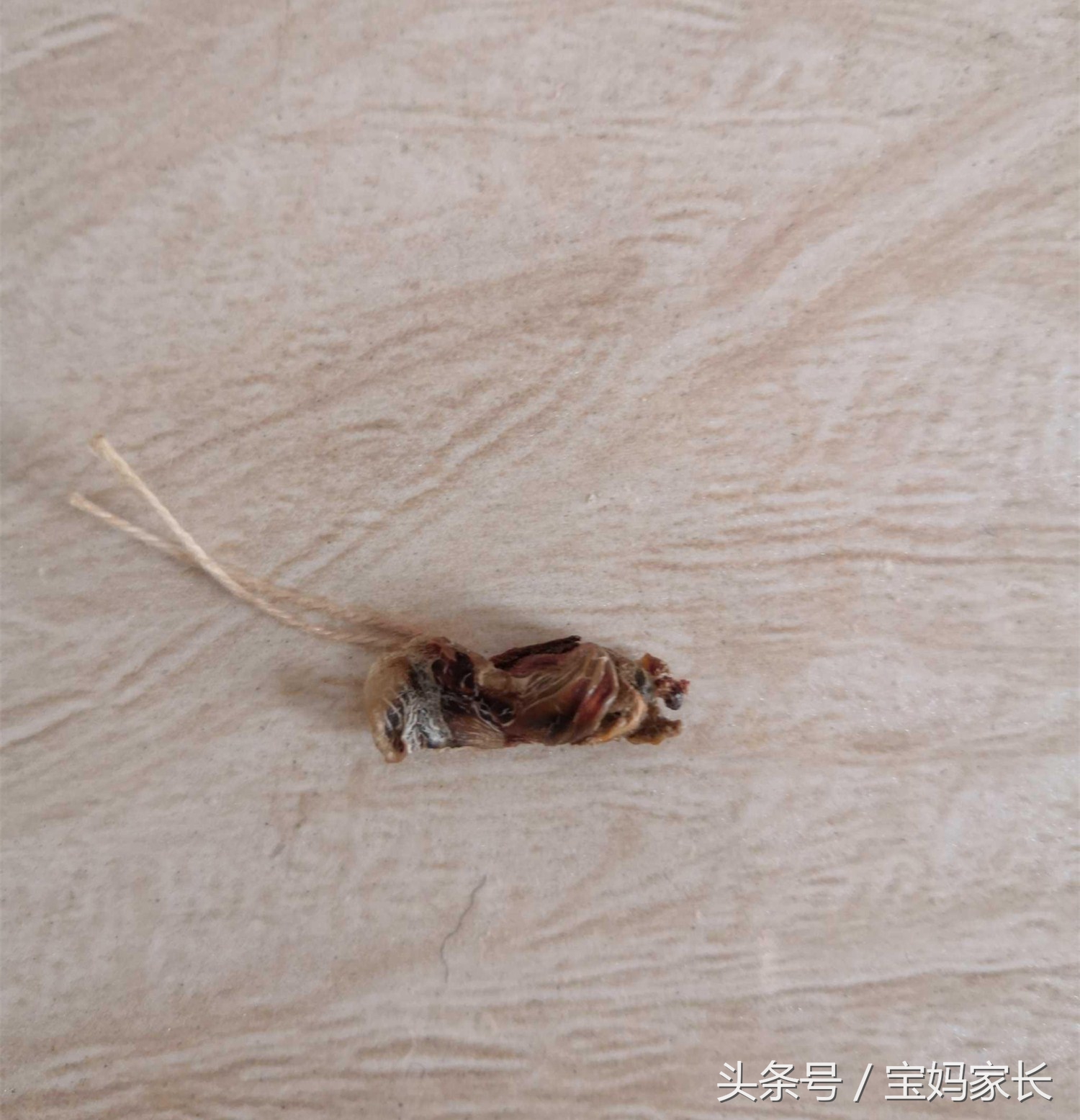 新生儿脐带不护理可以吗,胎儿剪断后的脐带自然脱落吗