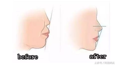 从3分到10分中间需要几分钟,从3分到4分付出了多大努力