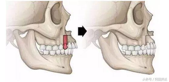从3分到10分中间需要几分钟,从3分到4分付出了多大努力